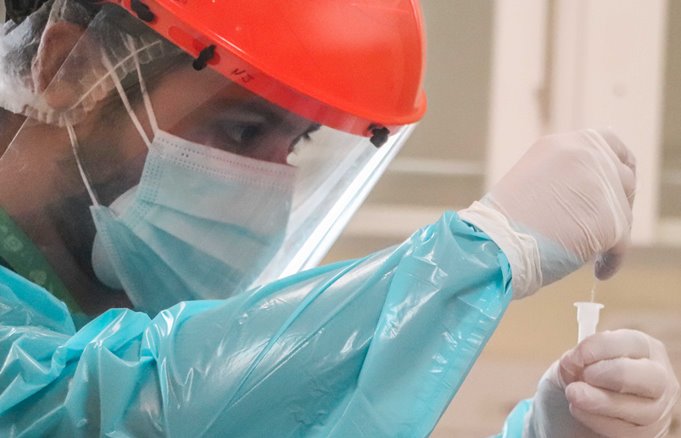 Test de antígenos como herramienta de apoyo en la detección rápida del covid-19