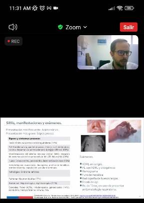 O’Higgins avanza en la eliminación de la transmisión de madre al hijo de Sífilis y VIH